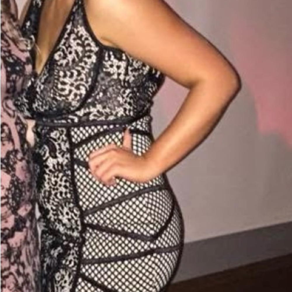 Chic Black and White Lace Dress